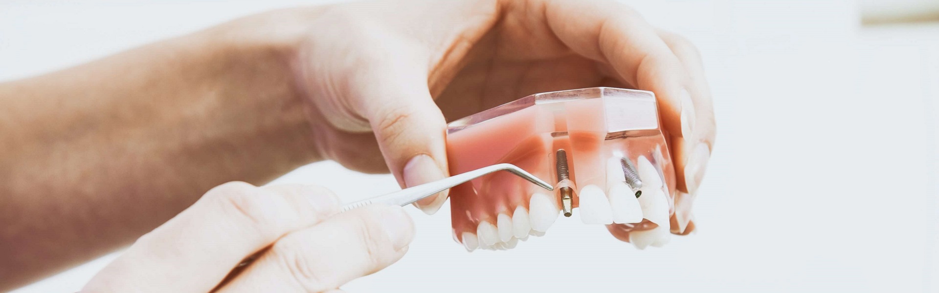 Fizikalna terapija | Zubni implanti Beograd