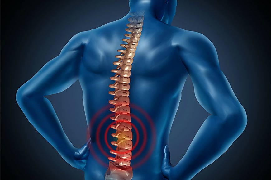 Physical therapy of the back and neck| Treatment of disc herniation