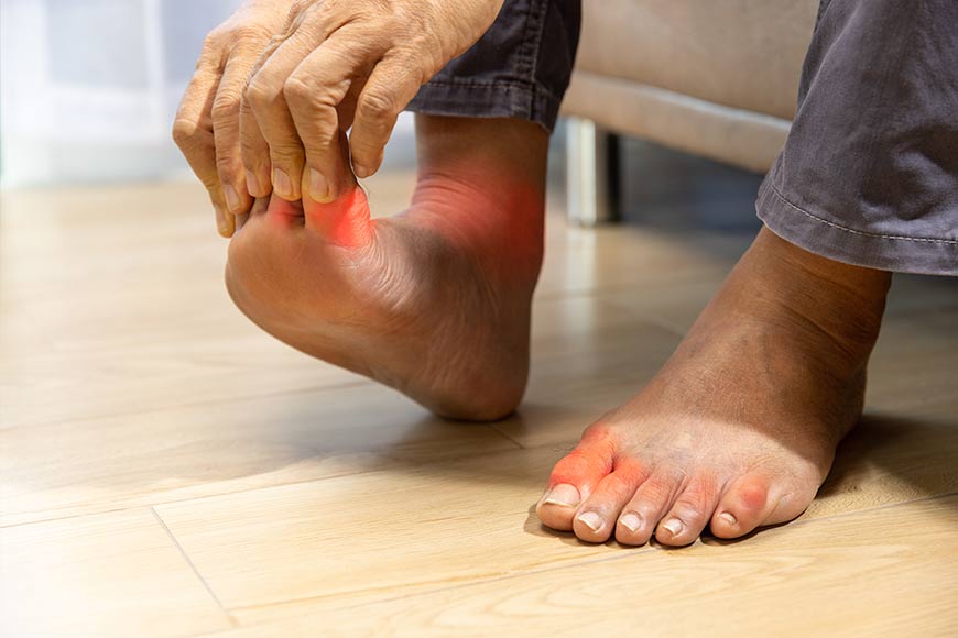 Physical therapy Belgrade | Toe pain